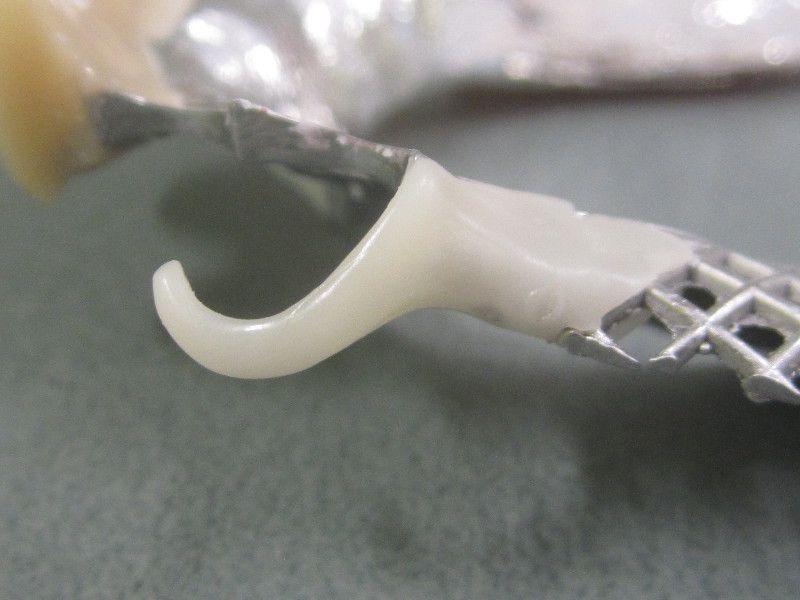 Tooth Coloured Flexible Clasps Dentacast